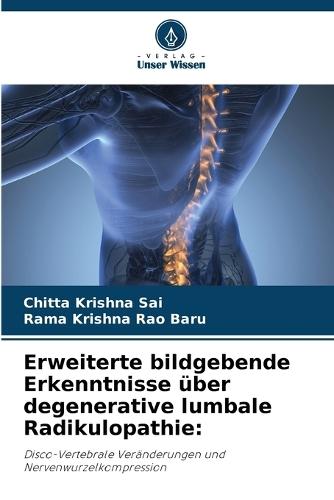 Erweiterte bildgebende Erkenntnisse über degenerative lumbale Radikulopathie