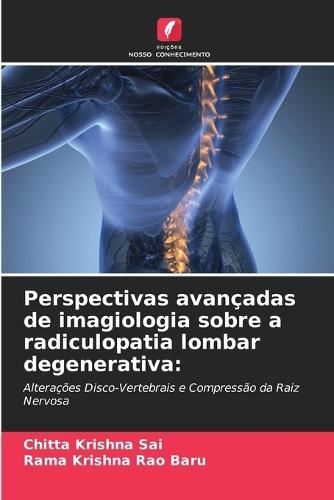 Perspectivas avançadas de imagiologia sobre a radiculopatia lombar degenerativa