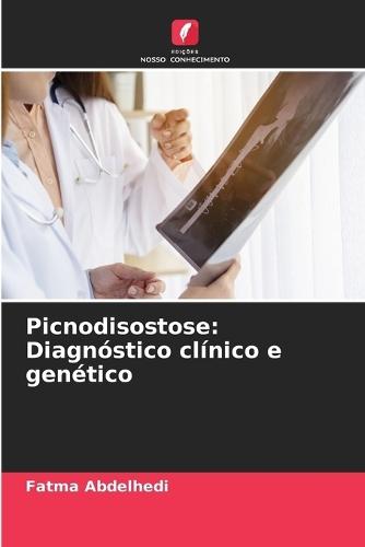 Picnodisostose: Diagnóstico clínico e genético