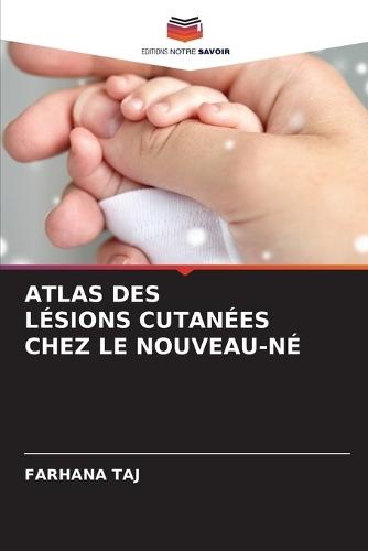 Atlas Des Lésions Cutanées Chez Le Nouveau-Né