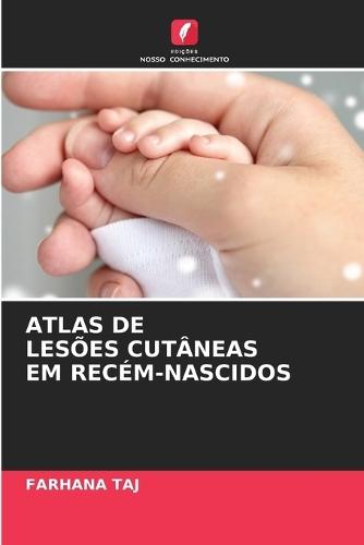 Atlas de Lesões Cutâneas Em Recém-Nascidos
