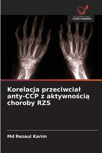 Korelacja przeciwcial anty-CCP z aktywnością choroby RZS