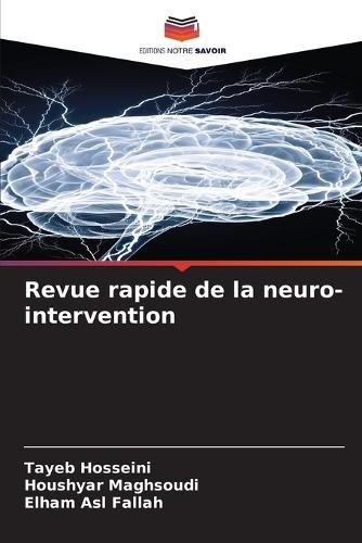 Revue rapide de la neuro-intervention