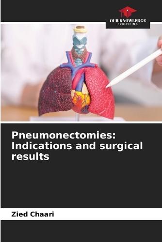 Pneumonectomies: Indications and surgical results