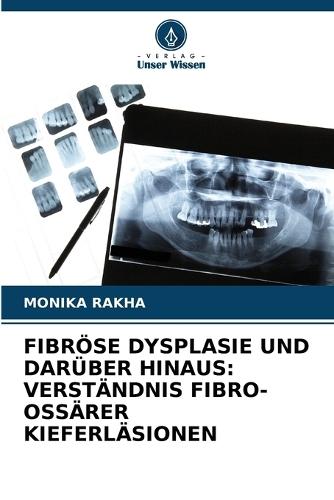 Fibröse Dysplasie Und Darüber Hinaus: Verständnis Fibro-Ossärer Kieferläsionen