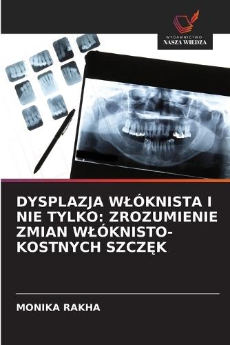 Dysplazja Wlóknista I Nie Tylko: Zrozumienie Zmian Wlóknisto-Kostnych SzczĘk