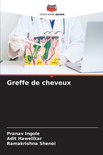 Greffe de cheveux