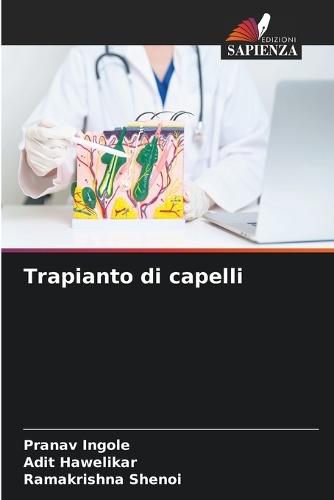 Trapianto di capelli