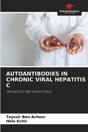 Autoantibodies in Chronic Viral Hepatitis C