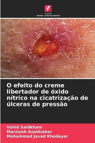 O efeito do creme libertador de óxido nítrico na cicatrização de úlceras de pressão