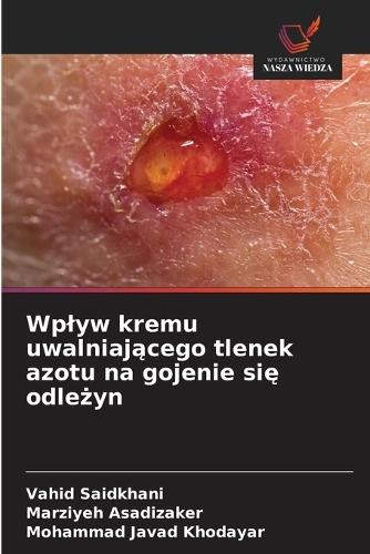 Wplyw kremu uwalniającego tlenek azotu na gojenie się odleżyn