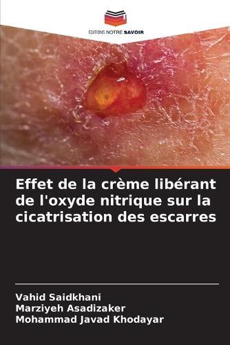 Effet de la crème libérant de l'oxyde nitrique sur la cicatrisation des escarres
