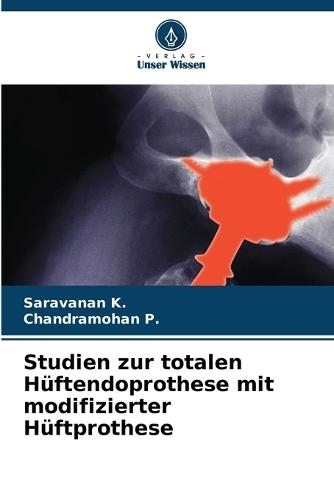 Studien zur totalen Hüftendoprothese mit modifizierter Hüftprothese