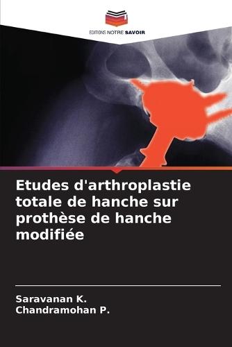 Etudes d'arthroplastie totale de hanche sur prothèse de hanche modifiée
