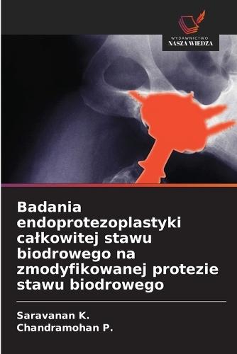Badania endoprotezoplastyki calkowitej stawu biodrowego na zmodyfikowanej protezie stawu biodrowego