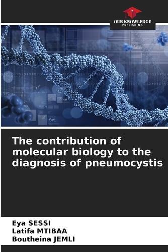 The contribution of molecular biology to the diagnosis of pneumocystis