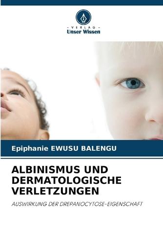 Albinismus Und Dermatologische Verletzungen