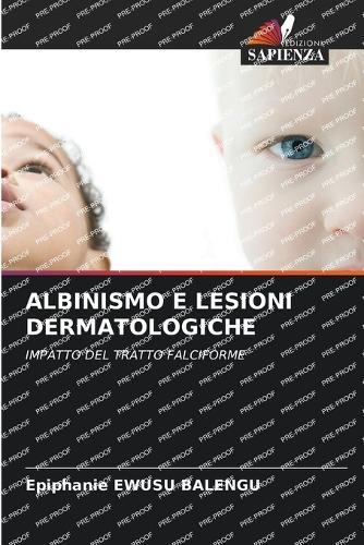 Albinismo E Lesioni Dermatologiche