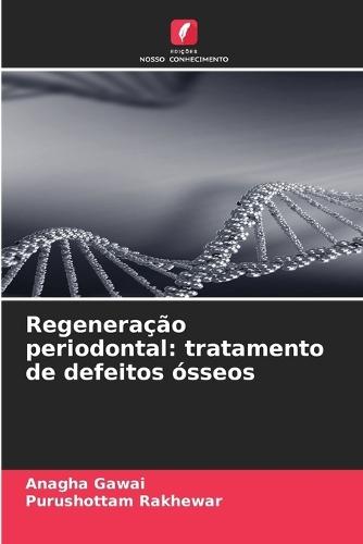 Regeneração periodontal: tratamento de defeitos ósseos