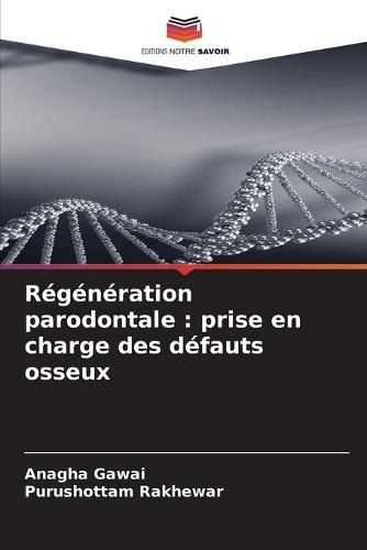 Régénération parodontale: prise en charge des défauts osseux