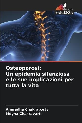 Osteoporosi: Un'epidemia silenziosa e le sue implicazioni per tutta la vita