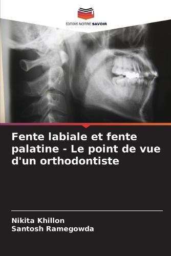 Fente labiale et fente palatine - Le point de vue d'un orthodontiste