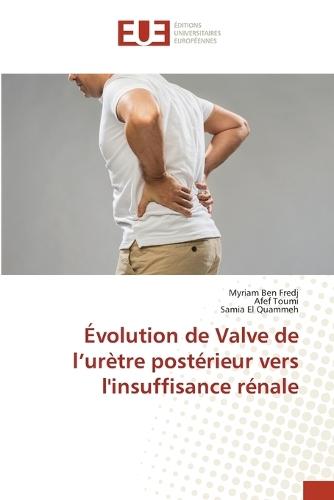 Évolution de Valve de l'urètre postérieur vers l'insuffisance rénale
