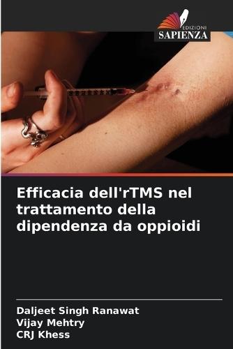 Efficacia dell'rTMS nel trattamento della dipendenza da oppioidi