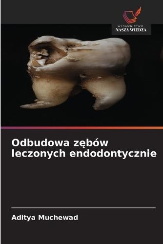 Odbudowa zębów leczonych endodontycznie