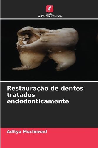 Restauração de dentes tratados endodonticamente