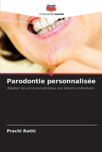 Parodontie personnalisée