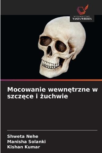 Mocowanie wewnętrzne w szczęce i żuchwie
