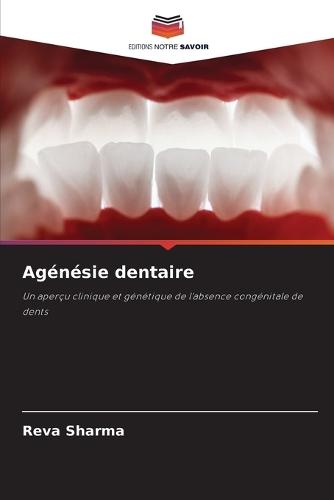 Agénésie dentaire