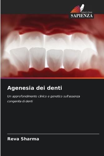 Agenesia dei denti