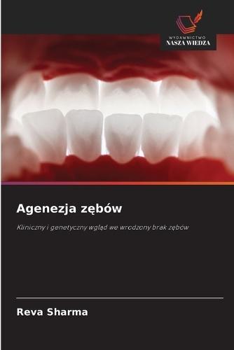 Agenezja zębów