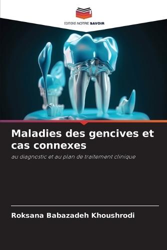 Maladies des gencives et cas connexes