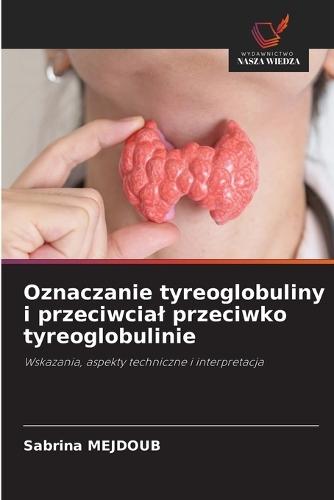 Oznaczanie tyreoglobuliny i przeciwcial przeciwko tyreoglobulinie