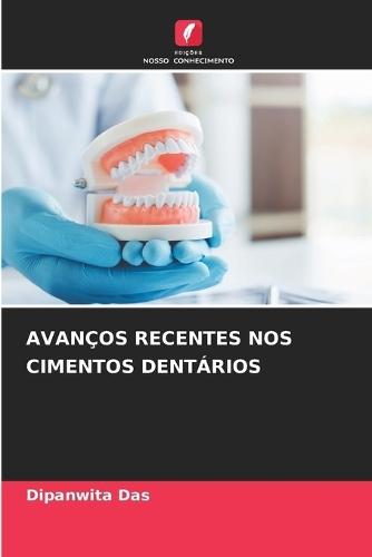Avanços Recentes Nos Cimentos Dentários