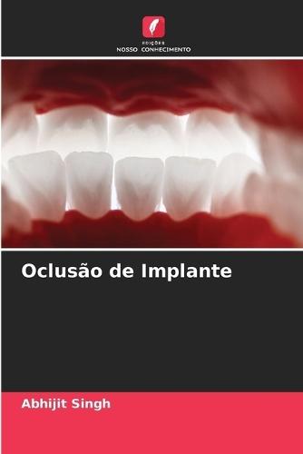Oclusão de Implante