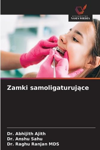 Zamki samoligaturujące