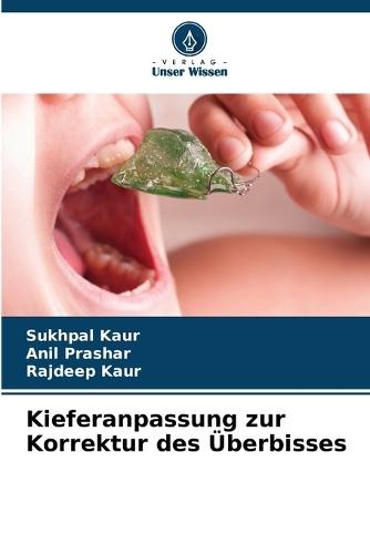 Kieferanpassung zur Korrektur des Überbisses