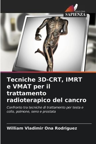 Tecniche 3D-CRT, IMRT e VMAT per il trattamento radioterapico del cancro