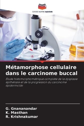Métamorphose cellulaire dans le carcinome buccal