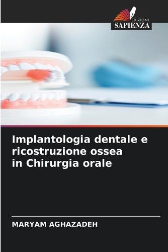 Implantologia dentale e ricostruzione ossea in Chirurgia orale