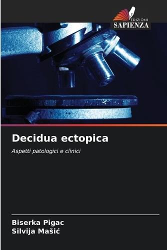 Decidua ectopica