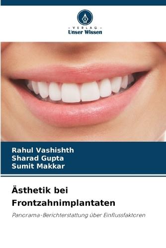 Ästhetik bei Frontzahnimplantaten