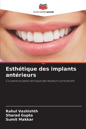 Esthétique des implants antérieurs