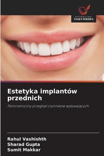 Estetyka implantów przednich