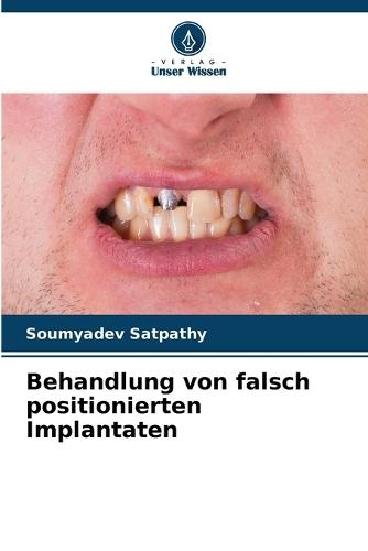Behandlung von falsch positionierten Implantaten