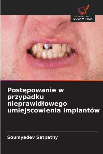 Postępowanie w przypadku nieprawidlowego umiejscowienia implantów